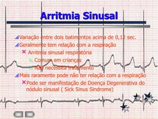 Arritmia Sinusal

 Variação entre dois batimentos acima de 0,12 sec.
 Geralmente tem relação com a respiração
    Arritmia sinusal respiratória
      Comum em crianças
      Não necessita tratamento
 Mais raramente pode não ter relação com a respiração
   Pode ser manifestação de Doença Degenerativa do
     nódulo sinusal ( Sick Sinus Sindrome)
 