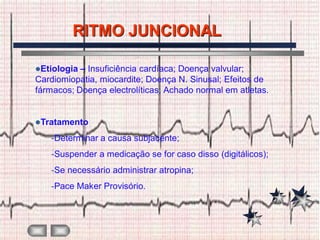 RITMO JUNCIONAL

Etiologia – Insuficiência cardíaca; Doença valvular;
Cardiomiopatia, miocardite; Doença N. Sinusal; Efeitos de
fármacos; Doença electrolíticas; Achado normal em atletas.


Tratamento

   -Determinar a causa subjacente;
   -Suspender a medicação se for caso disso (digitálicos);
   -Se necessário administrar atropina;
   -Pace Maker Provisório.
 