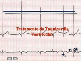 Tratamento da Taquicardia
      Ventricular
 