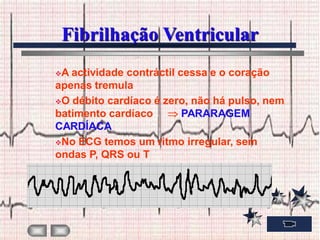 Fibrilhação Ventricular
A actividade contráctil cessa e o coração
apenas tremula
O débito cardíaco é zero, não há pulso, nem
batimento cardíaco        PARARAGEM
CARDÍACA
No ECG temos um ritmo irregular, sem
ondas P, QRS ou T
 
