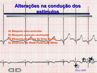 Alterações na condução dos
             estímulos


A) Bloqueio sino-auricular
B) Bloqueio auriculo-ventricular
C) Bloqueio de ramos do feixe de His
D) Síndrome de Wolff-Parkinson-White




                                       Maio 2008
 