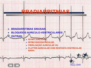 BRADIARRITMIAS

 BRADIARRITMIAS SINUSAIS
 BLOQUEIOS AURICULO-VENTRICULARES
 OUTRAS:
              RITMO JUNCIONAL,
              RITMO IDIOVENTRICULAR,
              FIBRILHAÇÃO AURICULAR OU
              FLUTTER AURICULAR COM RESPOSTA VENTRICULAR
               BAIXA.




                                                Maio 2008
 