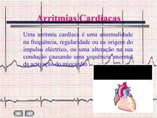Arritmias Cardíacas
Uma arritmia cardíaca é uma anormalidade
na frequência, regularidade ou na origem do
impulso eléctrico, ou uma alteração na sua
condução causando uma sequência anormal
da activação do miocárdio .
 