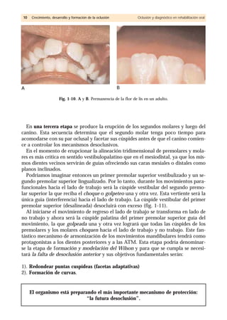 En una tercera etapa se produce la erupción de los segundos molares y luego del
canino. Esta secuencia determina que el segundo molar tenga poco tiempo para
acomodarse con su par oclusal y facetar sus cúspides antes de que el canino comien-
ce a controlar los mecanismos desoclusivos.
En el momento de erupcionar la alineación tridimensional de premolares y mola-
res es más crítica en sentido vestibulopalatino que en el mesiodistal, ya que los mis-
mos dientes vecinos servirán de guías ofreciendo sus caras mesiales o distales como
planos inclinados.
Podríamos imaginar entonces un primer premolar superior vestibulizado y un se-
gundo premolar superior lingualizado. Por lo tanto, durante los movimientos para-
funcionales hacia el lado de trabajo será la cúspide vestibular del segundo premo-
lar superior la que reciba el choque o golpeteo una y otra vez. Esta vertiente será la
única guía (interferencia) hacia el lado de trabajo. La cúspide vestibular del primer
premolar superior (desalineada) desocluirá con exceso (fig. 1-11).
Al iniciarse el movimiento de regreso el lado de trabajo se transforma en lado de
no trabajo y ahora será la cúspide palatina del primer premolar superior guía del
movimiento, la que golpeada una y otra vez logrará que todas las cúspides de los
premolares y los molares choquen hacia el lado de trabajo y no trabajo. Este fan-
tástico mecanismo de armonización de los movimientos mandibulares tendrá como
protagonistas a los dientes posteriores y a las ATM. Esta etapa podría denominar-
se la etapa de formación y modelación del Wilson y para que se cumpla se necesi-
tará la falta de desoclusión anterior y sus objetivos fundamentales serán:
1). Redondear puntas cuspídeas (facetas adaptativas)
2). Formación de curvas.
El organismo está preparando el más importante mecanismo de protección:
“la futura desoclusión”.
1100 Crecimiento, desarrollo y formación de la oclusión Oclusión y diagnóstico en rehabilitación oral
Fig. 1-10. A y B. Permanencia de la flor de lis en un adulto.
BA
 