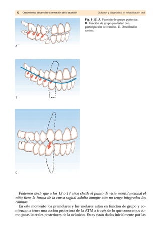 Podemos decir que a los 13 o 14 años desde el punto de vista morfofuncional el
niño tiene la forma de la curva sagital adulta aunque aún no tenga integrados los
caninos.
En este momento los premolares y los molares están en función de grupo y co-
mienzan a tener una acción protectora de la ATM a través de lo que conocemos co-
mo guías laterales posteriores de la oclusión. Éstas están dadas inicialmente por las
1122 Crecimiento, desarrollo y formación de la oclusión Oclusión y diagnóstico en rehabilitación oral
Fig. 1-12. A. Función de grupo posterior.
B. Función de grupo posterior con
participación del canino. C. Desoclusión
canina.
A
B
C
 