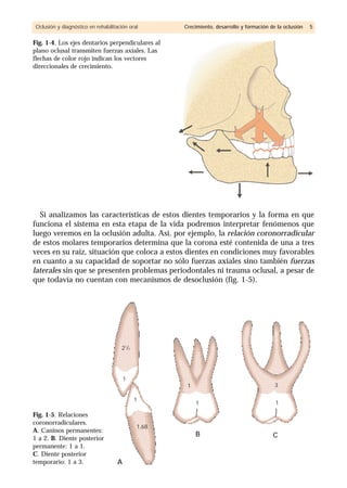 Si analizamos las características de estos dientes temporarios y la forma en que
funciona el sistema en esta etapa de la vida podremos interpretar fenómenos que
luego veremos en la oclusión adulta. Así, por ejemplo, la relación coronorradicular
de estos molares temporarios determina que la corona esté contenida de una a tres
veces en su raíz, situación que coloca a estos dientes en condiciones muy favorables
en cuanto a su capacidad de soportar no sólo fuerzas axiales sino también fuerzas
laterales sin que se presenten problemas periodontales ni trauma oclusal, a pesar de
que todavía no cuentan con mecanismos de desoclusión (fig. 1-5).
Oclusión y diagnóstico en rehabilitación oral Crecimiento, desarrollo y formación de la oclusión 5
Fig. 1-4. Los ejes dentarios perpendiculares al
plano oclusal transmiten fuerzas axiales. Las
flechas de color rojo indican los vectores
direccionales de crecimiento.
Fig. 1-5. Relaciones
coronorradiculares.
A. Caninos permanentes:
1 a 2. B. Diente posterior
permanente: 1 a 1.
C. Diente posterior
temporario: 1 a 3.
21
/2
1
1
A
B C
1
1 1
3
1,68
 