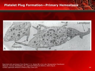 14
Platelet Plug Formation—Primary Hemostasis
Reprinted with permission from Rinder C. In: Spiess BD, et al, eds. Perioperative Transfusion
Medicine. 2nd ed. Philadelphia, PA: Lippincott Williams & Wilkins; 2005:chap 8.
©2005 Lippincott Williams & Wilkins http://lww.com
 