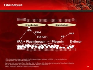 17
Fibrinolysis
tPA=tissue plasminogen activator; PAI-1=plasminogen activator inhibitor 1; AP=anti-plasmin;
PAP=plasmin-anti-plasmin complexes.
Reprinted with permission from Chandler WL. In: Spiess BD, et al, eds. Perioperative Transfusion Medicine.
2nd ed. Philadelphia, PA: Lippincott Williams & Wilkins; 2005:chap 7.
©2005 Lippincott Williams & Wilkins http://lww.com
Endothelium Endothelium
tPA
PAI-1
tPA-PAI-1
PAP
AP
D-dimerPlasmintPA + Plasminogen
 