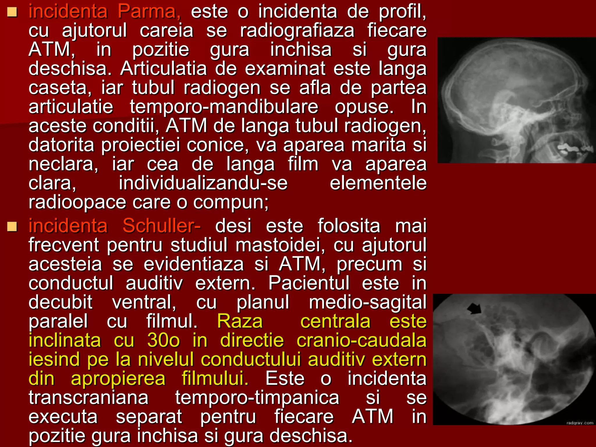  incidenta Parma, este o incidenta de profil,
cu ajutorul careia se radiografiaza fiecare
ATM, in pozitie gura inchisa si gura
deschisa. Articulatia de examinat este langa
caseta, iar tubul radiogen se afla de partea
articulatie temporo-mandibulare opuse. In
aceste conditii, ATM de langa tubul radiogen,
datorita proiectiei conice, va aparea marita si
neclara, iar cea de langa film va aparea
clara, individualizandu-se elementele
radioopace care o compun;
 incidenta Schuller- desi este folosita mai
frecvent pentru studiul mastoidei, cu ajutorul
acesteia se evidentiaza si ATM, precum si
conductul auditiv extern. Pacientul este in
decubit ventral, cu planul medio-sagital
paralel cu filmul. Raza centrala este
inclinata cu 30o in directie cranio-caudala
iesind pe la nivelul conductului auditiv extern
din apropierea filmului. Este o incidenta
transcraniana temporo-timpanica si se
executa separat pentru fiecare ATM in
pozitie gura inchisa si gura deschisa.
 