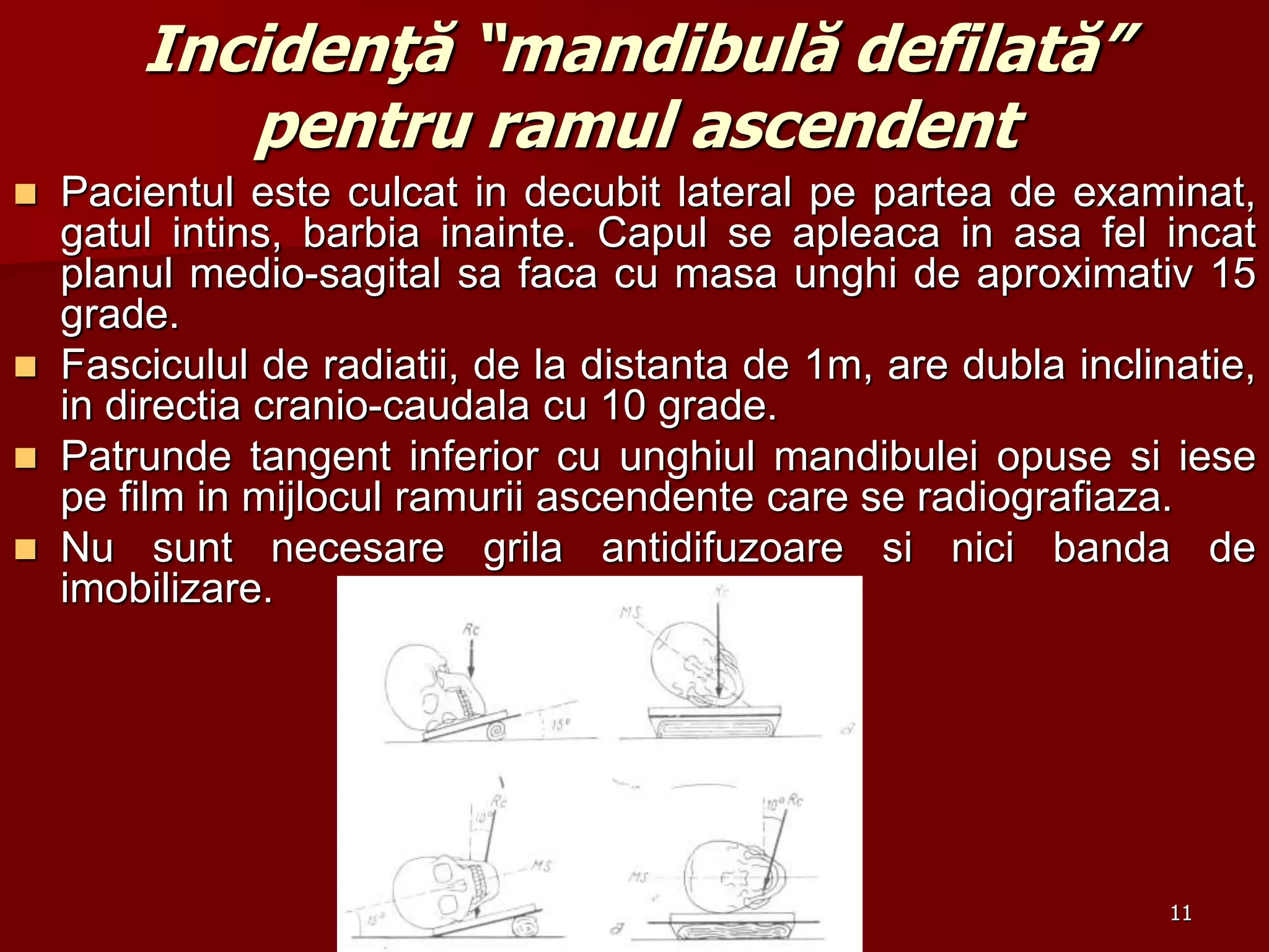 Incidenţă “mandibulă defilată”
pentru ramul ascendent
 Pacientul este culcat in decubit lateral pe partea de examinat,
gatul intins, barbia inainte. Capul se apleaca in asa fel incat
planul medio-sagital sa faca cu masa unghi de aproximativ 15
grade.
 Fasciculul de radiatii, de la distanta de 1m, are dubla inclinatie,
in directia cranio-caudala cu 10 grade.
 Patrunde tangent inferior cu unghiul mandibulei opuse si iese
pe film in mijlocul ramurii ascendente care se radiografiaza.
 Nu sunt necesare grila antidifuzoare si nici banda de
imobilizare.
11
 