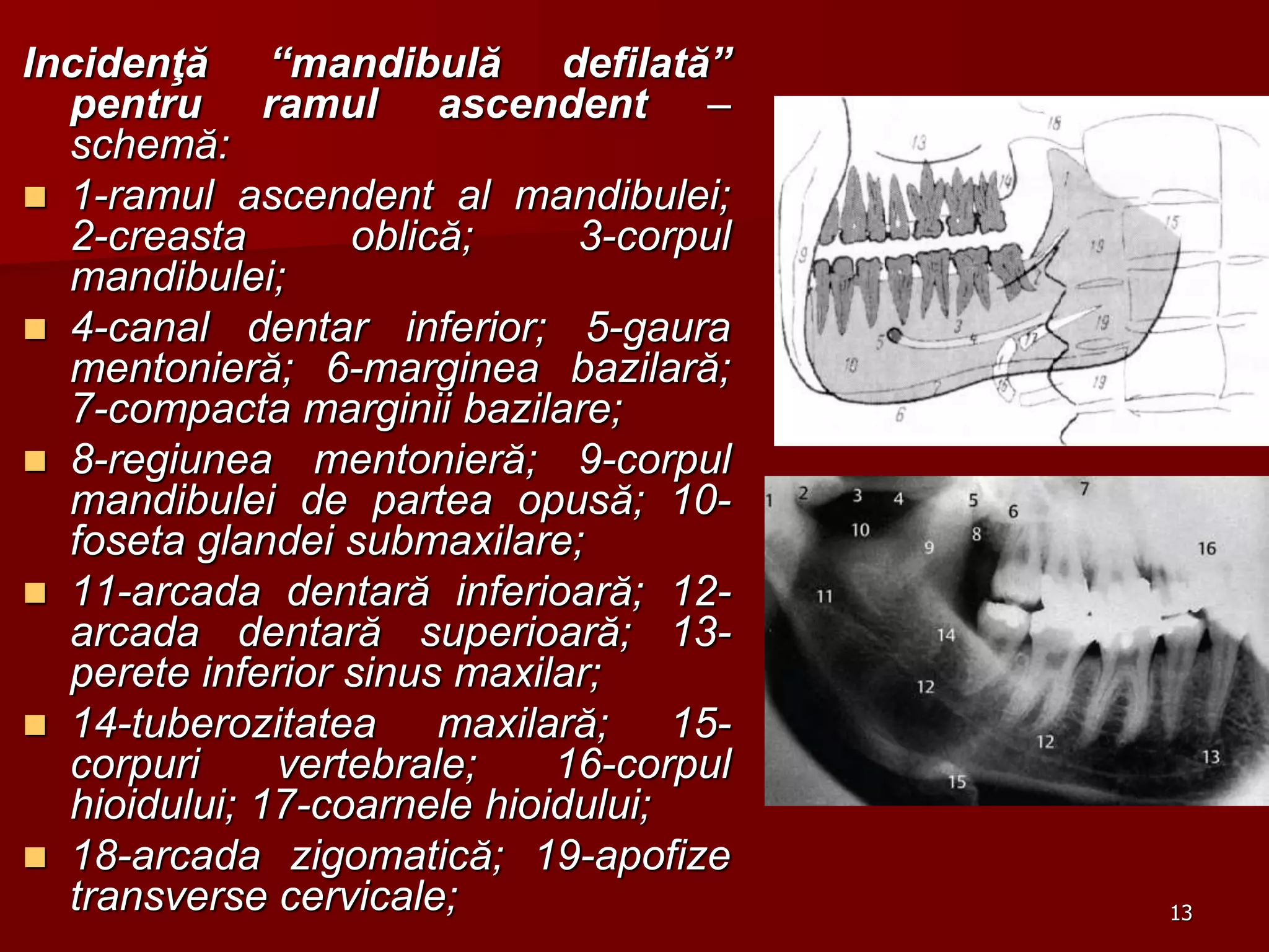 13
Incidenţă “mandibulă defilată”
pentru ramul ascendent –
schemă:
 1-ramul ascendent al mandibulei;
2-creasta oblică; 3-corpul
mandibulei;
 4-canal dentar inferior; 5-gaura
mentonieră; 6-marginea bazilară;
7-compacta marginii bazilare;
 8-regiunea mentonieră; 9-corpul
mandibulei de partea opusă; 10-
foseta glandei submaxilare;
 11-arcada dentară inferioară; 12-
arcada dentară superioară; 13-
perete inferior sinus maxilar;
 14-tuberozitatea maxilară; 15-
corpuri vertebrale; 16-corpul
hioidului; 17-coarnele hioidului;
 18-arcada zigomatică; 19-apofize
transverse cervicale;
 