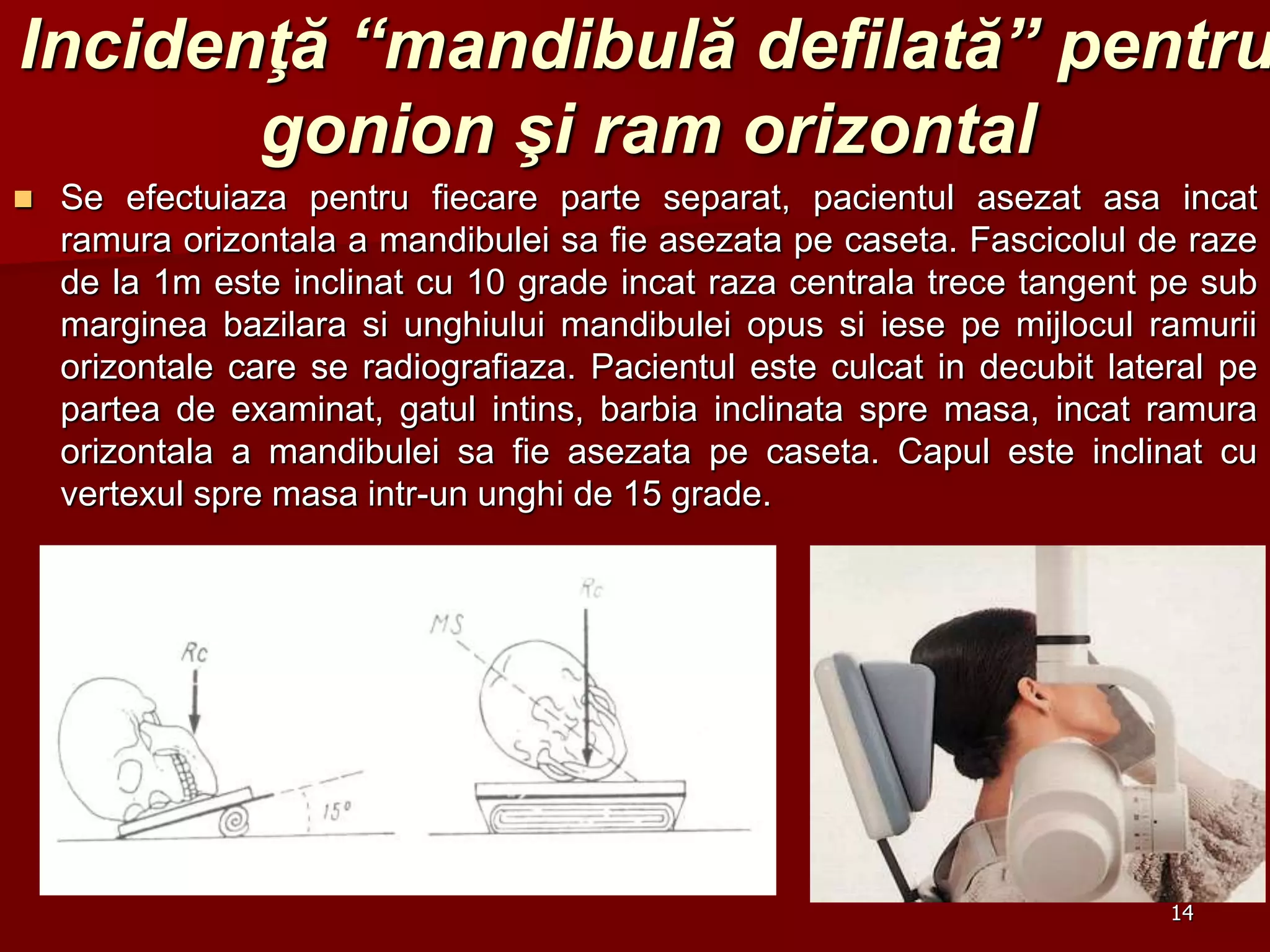 Incidenţă “mandibulă defilată” pentru
gonion şi ram orizontal
 Se efectuiaza pentru fiecare parte separat, pacientul asezat asa incat
ramura orizontala a mandibulei sa fie asezata pe caseta. Fascicolul de raze
de la 1m este inclinat cu 10 grade incat raza centrala trece tangent pe sub
marginea bazilara si unghiului mandibulei opus si iese pe mijlocul ramurii
orizontale care se radiografiaza. Pacientul este culcat in decubit lateral pe
partea de examinat, gatul intins, barbia inclinata spre masa, incat ramura
orizontala a mandibulei sa fie asezata pe caseta. Capul este inclinat cu
vertexul spre masa intr-un unghi de 15 grade.
14
 