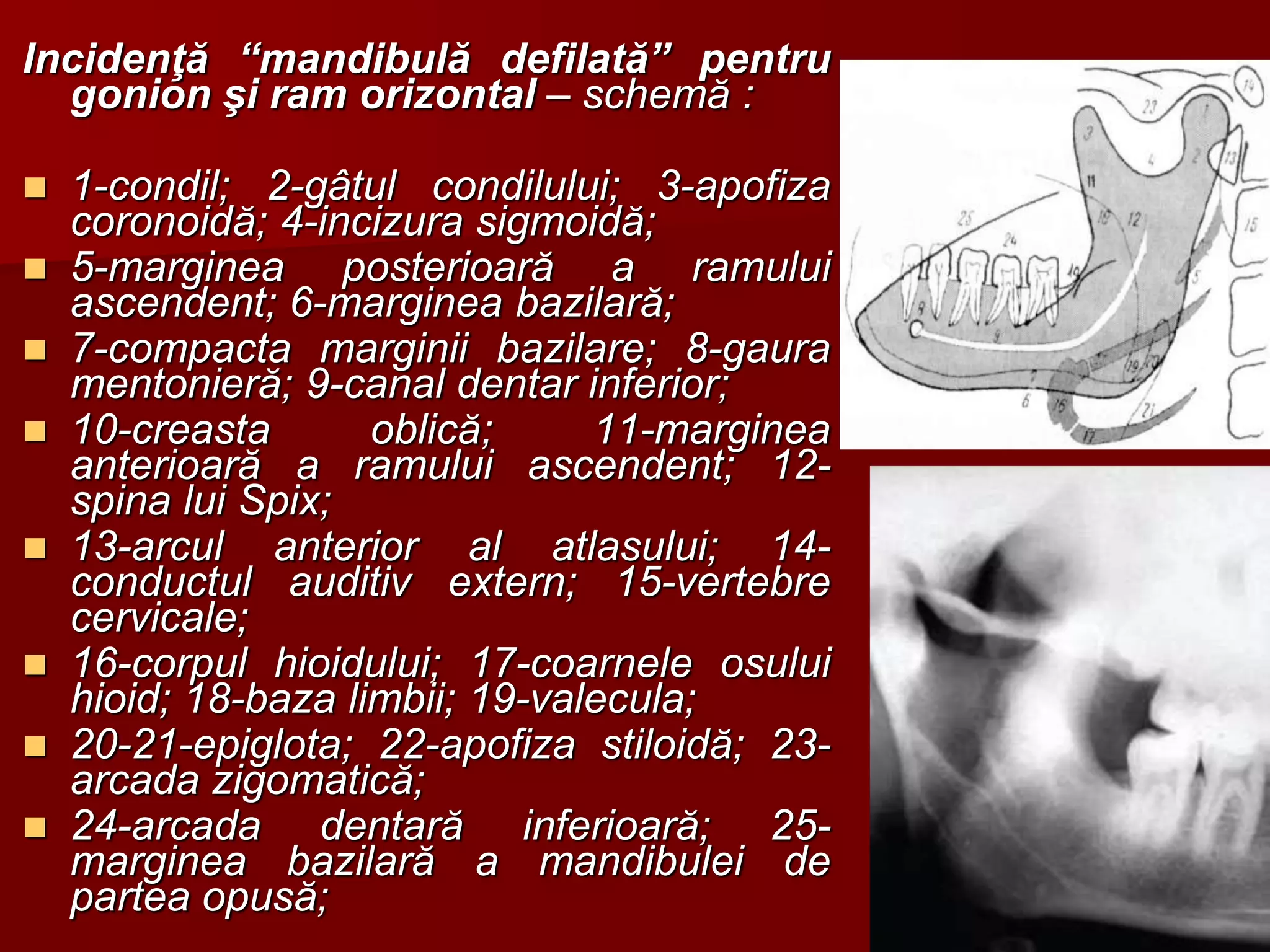 15
Incidenţă “mandibulă defilată” pentru
gonion şi ram orizontal – schemă :
 1-condil; 2-gâtul condilului; 3-apofiza
coronoidă; 4-incizura sigmoidă;
 5-marginea posterioară a ramului
ascendent; 6-marginea bazilară;
 7-compacta marginii bazilare; 8-gaura
mentonieră; 9-canal dentar inferior;
 10-creasta oblică; 11-marginea
anterioară a ramului ascendent; 12-
spina lui Spix;
 13-arcul anterior al atlasului; 14-
conductul auditiv extern; 15-vertebre
cervicale;
 16-corpul hioidului; 17-coarnele osului
hioid; 18-baza limbii; 19-valecula;
 20-21-epiglota; 22-apofiza stiloidă; 23-
arcada zigomatică;
 24-arcada dentară inferioară; 25-
marginea bazilară a mandibulei de
partea opusă;
 