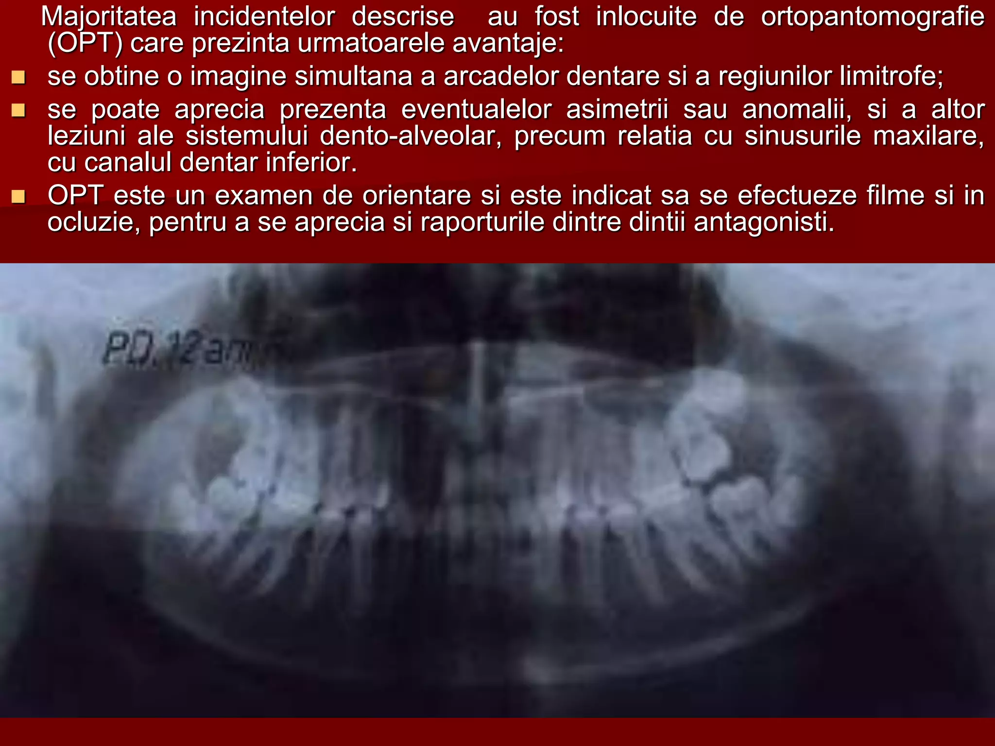 Majoritatea incidentelor descrise au fost inlocuite de ortopantomografie
(OPT) care prezinta urmatoarele avantaje:
 se obtine o imagine simultana a arcadelor dentare si a regiunilor limitrofe;
 se poate aprecia prezenta eventualelor asimetrii sau anomalii, si a altor
leziuni ale sistemului dento-alveolar, precum relatia cu sinusurile maxilare,
cu canalul dentar inferior.
 OPT este un examen de orientare si este indicat sa se efectueze filme si in
ocluzie, pentru a se aprecia si raporturile dintre dintii antagonisti.
 