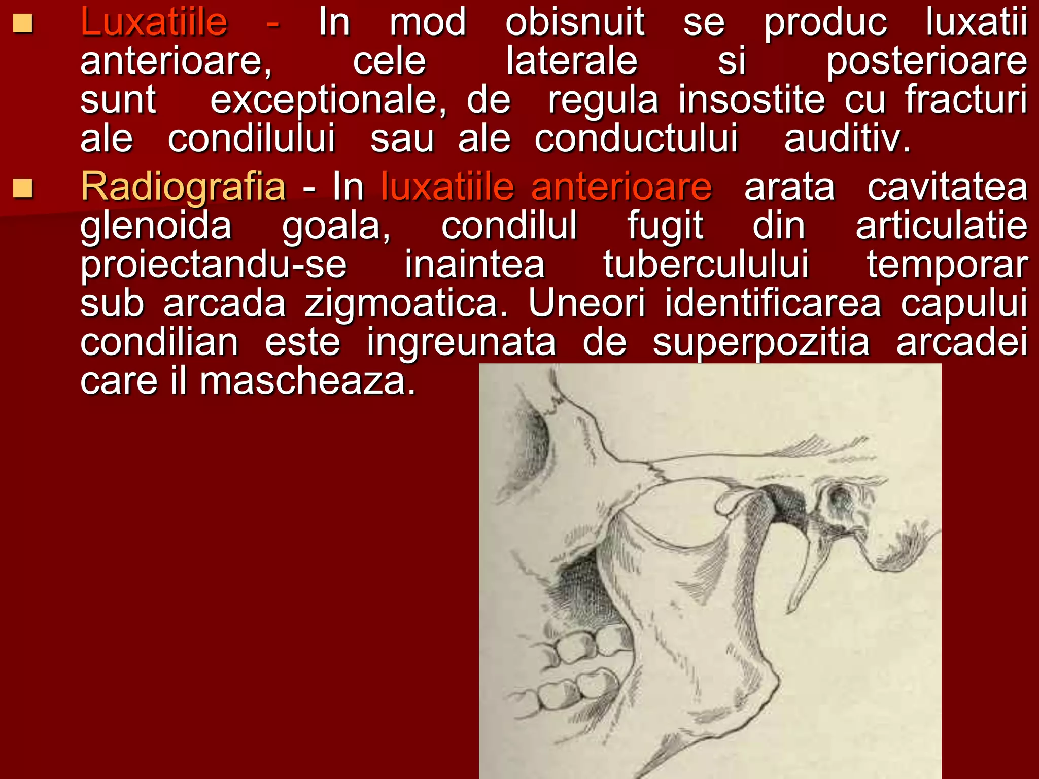  Luxatiile - In mod obisnuit se produc luxatii
anterioare, cele laterale si posterioare
sunt exceptionale, de regula insostite cu fracturi
ale condilului sau ale conductului auditiv.
 Radiografia - In luxatiile anterioare arata cavitatea
glenoida goala, condilul fugit din articulatie
proiectandu-se inaintea tuberculului temporar
sub arcada zigmoatica. Uneori identificarea capului
condilian este ingreunata de superpozitia arcadei
care il mascheaza.
 