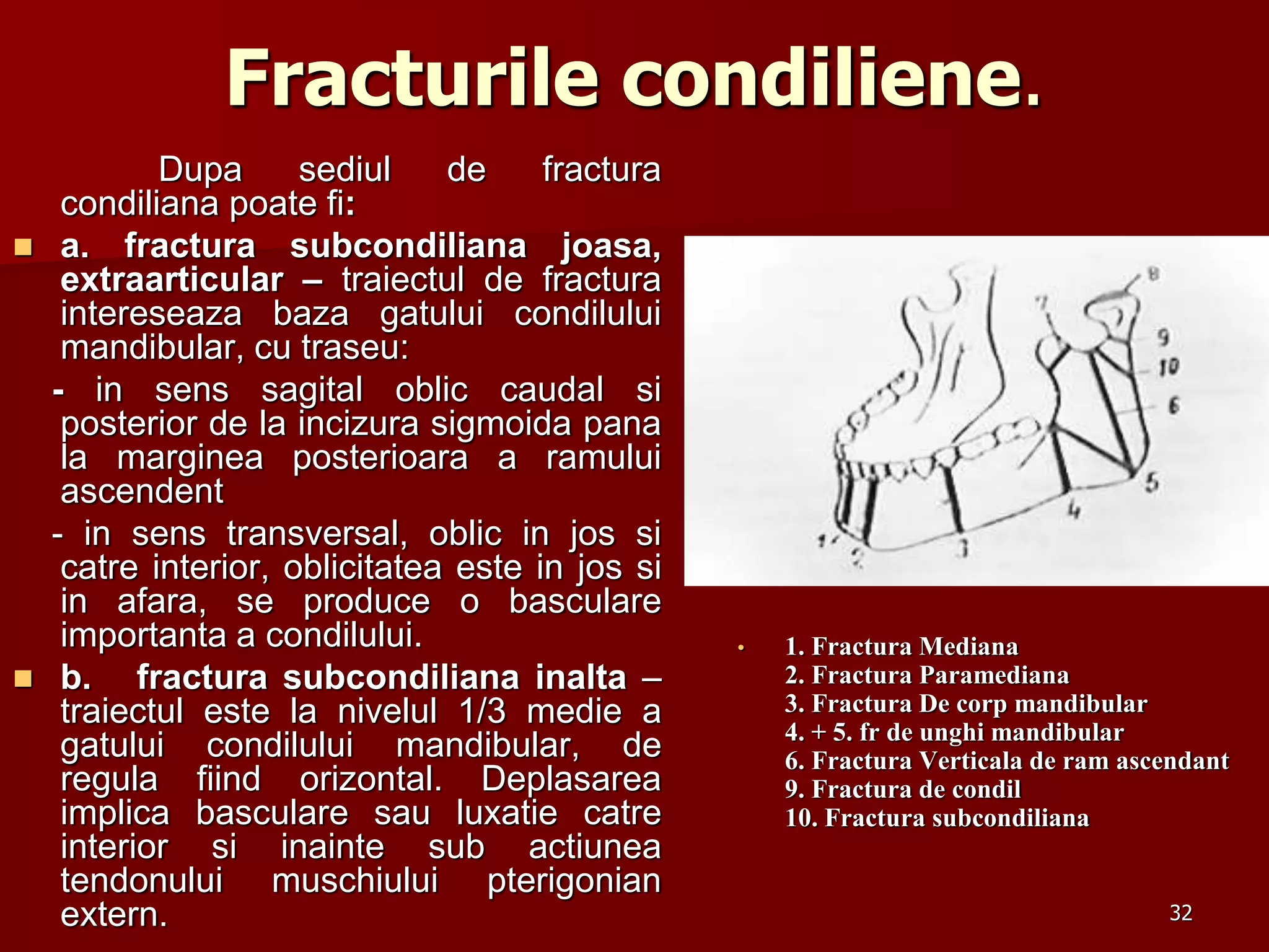 Fracturile condiliene.
• 1. Fractura Mediana
2. Fractura Paramediana
3. Fractura De corp mandibular
4. + 5. fr de unghi mandibular
6. Fractura Verticala de ram ascendant
9. Fractura de condil
10. Fractura subcondiliana
Dupa sediul de fractura
condiliana poate fi:
 a. fractura subcondiliana joasa,
extraarticular – traiectul de fractura
intereseaza baza gatului condilului
mandibular, cu traseu:
- in sens sagital oblic caudal si
posterior de la incizura sigmoida pana
la marginea posterioara a ramului
ascendent
- in sens transversal, oblic in jos si
catre interior, oblicitatea este in jos si
in afara, se produce o basculare
importanta a condilului.
 b. fractura subcondiliana inalta –
traiectul este la nivelul 1/3 medie a
gatului condilului mandibular, de
regula fiind orizontal. Deplasarea
implica basculare sau luxatie catre
interior si inainte sub actiunea
tendonului muschiului pterigonian
extern. 32
 