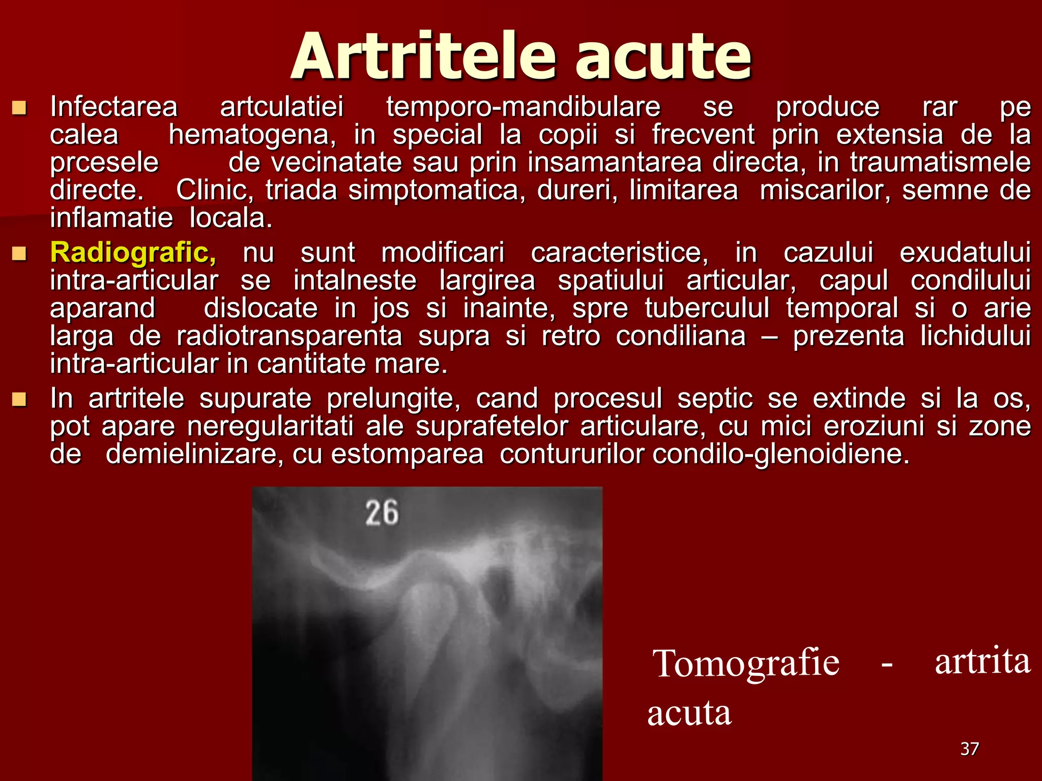 37
Artritele acute
 Infectarea artculatiei temporo-mandibulare se produce rar pe
calea hematogena, in special la copii si frecvent prin extensia de la
prcesele de vecinatate sau prin insamantarea directa, in traumatismele
directe. Clinic, triada simptomatica, dureri, limitarea miscarilor, semne de
inflamatie locala.
 Radiografic, nu sunt modificari caracteristice, in cazului exudatului
intra-articular se intalneste largirea spatiului articular, capul condilului
aparand dislocate in jos si inainte, spre tuberculul temporal si o arie
larga de radiotransparenta supra si retro condiliana – prezenta lichidului
intra-articular in cantitate mare.
 In artritele supurate prelungite, cand procesul septic se extinde si la os,
pot apare neregularitati ale suprafetelor articulare, cu mici eroziuni si zone
de demielinizare, cu estomparea contururilor condilo-glenoidiene.
 