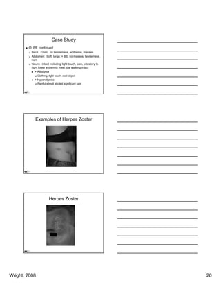 Case Study
        O: PE continued
          Back: From: no tenderness, erythema, masses
          Abdomen: Soft, large; + BS; no masses, tenderness,
          hsm
          Neuro: intact including light touch pain vibratory to
                                         touch, pain,
          right lower extremity; heel, toe walking intact
             + Allodynia
               Clothing, light touch, cool object
            + Hyperalgesia
               Painful stimuli elicited significant pain




            Examples of Herpes Zoster




                         Herpes Zoster




Wright, 2008                                                      20
 