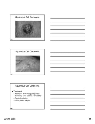 Squamous Cell Carcinoma




               Squamous Cell Carcinoma




               Squamous Cell Carcinoma

          Treatment
           Referral to dermatology or plastics
           depending upon location / availability
             p       g p                        y
           Electrodessication
           Excision with margins




Wright, 2008                                        34
 
