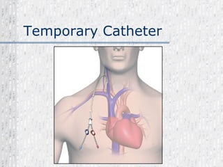 Temporary Catheter 