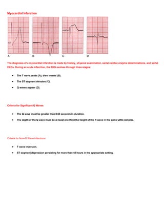 Myocardial Infarction




The diagnosis of a myocardial infarction is made by history, physical examination, serial cardiac enzyme determinations, and serial
EKGs. During an acute infarction, the EKG evolves through three stages:


        The T wave peaks (A), then inverts (B).

        The ST segment elevates (C).

        Q waves appear (D).




Criteria for Significant Q Waves


        The Q wave must be greater than 0.04 seconds in duration.

        The depth of the Q wave must be at least one third the height of the R wave in the same QRS complex.




Criteria for Non–Q Wave Infarctions


        T wave inversion.

        ST segment depression persisting for more than 48 hours in the appropriate setting.
 