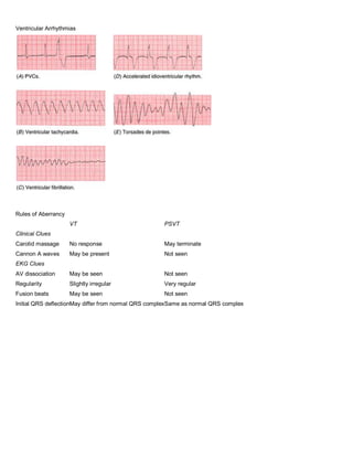 Ventricular Arrhythmias




Rules of Aberrancy
                     VT                              PSVT
Clinical Clues
Carotid massage      No response                     May terminate
Cannon A waves       May be present                  Not seen
EKG Clues
AV dissociation      May be seen                     Not seen
Regularity           Slightly irregular              Very regular
Fusion beats         May be seen                     Not seen
Initial QRS deflectionMay differ from normal QRS complexSame as normal QRS complex
 