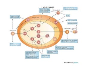 LYMPHOME
 