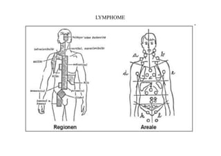 LYMPHOME
 
