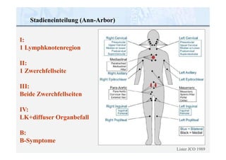 Stadieneinteilung (Ann-Arbor)
I:
1 Lymphknotenregion
II:
1 Zwerchfellseite
III:
Beide Zwerchfellseiten
IV:
LK+diffuser Organbefall
B:
B-Symptome
Lister JCO 1989
 