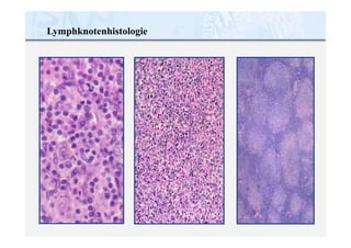 Lymphknotenhistologie
 