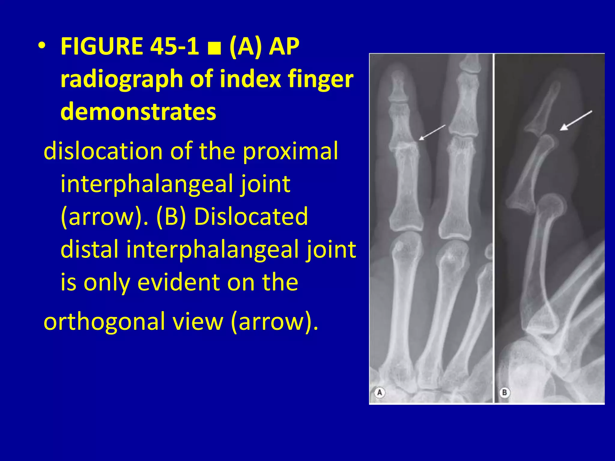 Imaging Techniques and Fundamental Observations for the Musculoskeletal ...