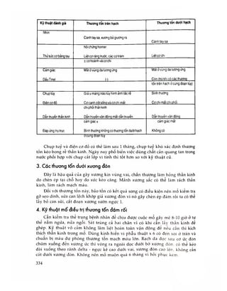 Kỹ thuật đánh giá Thương tồn trèn hạch Thương tổn dưới hạch
Nhìn
Cánh tay sạ, xương bà giương ra
Cánh tay sa
Thử sức cơ bằng tay
hội chứng horner
Liêt cơ răng trước, các cơ trám Liệtcơchi
± cơ hoành và cơ chi
Cảm giác
DấuTinel
Mảt ớ vùng da tương ứng
(-)
Mât ớvùng da tương ứng
Còn (trử khi có các thươna
tổn trên hạch ớ cùng đoạn lủy)
Chụp tủy
Điên cơ đồ
Giá u màng não túy hình ảnh tãc rê
Cơ canh CÒI sôna và cơchi mất
Bình thường
Cơ chi mất ch i Dhối
Dần truyền thần kinh
chi phòi thần kinh
Dần truyền vân đònq mất dẫn truyền Dần truyền vân đònq
Đáp ứng trụ trục
cảm giác ±
Binh thường không có thương tồn dưới hạch
cảm giác mất
Không có
ơcung ooạn tuy
Chụp tuỷ và điện cơ đồ có thế làm sau 1 tháng, chụp tuỷ khó xác định thương
tốn kéo bong rễ thần kinh. Ngày nay phố biến việc dùng chất cản quang tan trong
nước phôi hợp với chụp cắt lớp vi tính thì tốt hơn so với kỹ thuật củ.
3. Các thương tổn dưới xương đòn
Đây là hậu quả của gãy xương kín vùng vai, chấn thương làm hòng thần kinh
do chèn ép tại chỗ hay do sức kéo căng. Mảnh xương sắc có thể làm rách thần
kinh, làm rách mạch máu.
Đối với thương tổn này, bào tồn có kết quả song có điều kiện nên mổ kiểm tra
gỡ sẹo dính, sửa can lệch khớp giả xương đòn vì nó gây chèn ép đám rối ta có thể
lấy bỏ can sùi, cắt đoạn xương sườn ngực 1.
4. Kỹ thuật mô’ điều trị thương tổn đám rối
Cần kiếm tra thể trạng bệnh nhân để chịu được cuộc mổ gây mé 8-10 giờ ở tư
thê năm ngừa, nửa ngôi. Sát trùng cả hai chân vì có khi cần lấy thần kinh để
ghép. Kỹ thuật vô cảm không làm liệt hoàn toàn vận động để nếu cẩn thì kích
thích thân kinh trong mô. Dùng kính hiên vi phâu thuật X 6 có đèn soi ở trán và
chuân bị máu dự phòng thương tôn mạch máu lớn. Rạch da dọc sau cơ ức đòn
chũm xuống đen xương ức thì vòng ra ngoài dọc dưới bờ xương đòn, có thể kéo
dài xuông theo rãnh delta - ngực kê cao dưới vai, xương đòn cao lên, không cần
cắt dưới xương đòn. Không nên mổ muộn quá 6 tháng vì hồi phục kém.
334
 
