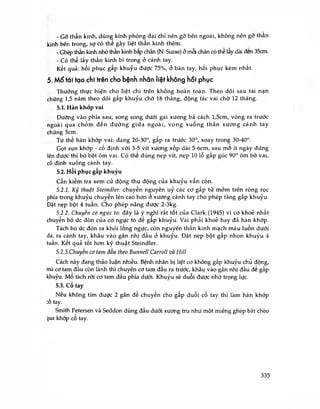 - Gỡ thần kinh, dùng; kính phóng đại chỉ nên gỡ bên ngoài, không nên gỡ thân
kinh bên trong, sợ có thể gây liệt thần kinh thêm.
- Ghép thần kinh nhò thần kinh bắp chân (N. Surae) ở mỗi chân có thế lấy dài đen 35cm.
- Có thể lấy thần kinh bì trong ỏ cánh tay.
Kết quả: hồi phục gấp khuỷu được 75°/ừ/ ở bàn tay, hồi phục kém nhất.
5. Mổ tói tạo chi trên cho bệnh nhân liệt không hồi phục
Thường thực hiện cho liệt chi trên không hoàn toàn. Theo dõi sau tai nạn
chừng 1,5 năm theo dõi gấp khuỷu chờ 18 tháng, động tác vai chờ 12 tháng.
5ểl. Hàn khớp vai
Đường vào phía sau, song song dưới gai xương bả cách 1,5cm, vòng ra trưốc
ngoải qua chỏm đến đường giứa ngoài, vòng xuống thân xương cánh tay
chừng 5cm.
Tư thế hàn khốp vai: dạng 20-30°, gấp ra trước 30°, xoay trong 30-40".
Gọt sụn khớp - cố định với 3-5 vít xương xốp dài 5-6cm, sau mo ít ngày đứng
lên được thì bó bột ôm vai. Có the dùng nẹp vít, nẹp 10 lỗ gấp góc 90° ôm bờ vai,
cố định xuống cánh tay.
5.2. Hồi phục gấp khuỷu
Cần kiếm tra xem cử động thụ động của khuỷu vẫn còn.
5.2.1. Kỹ thuật steindler: chuyến nguyên uỷ các cơ gấp từ mỏm trên ròng rọc
phía trong khuỷu chuyến lên cao hơn ỏ xương cánh tay cho phép tăng gấp khuỷu.
Đặt nẹp bột 4 tuần. Cho phép nâng được 2-3kg.
5.2.2. Chuyến cơ ngực to: đây là ý nghĩ rất tốt của Clark (1945) vì cơ khoẻ nhất
chuyển bó ức đòn của cơ ngực to đế gấp khuỷu. Vai phải khoẻ hay đã hàn khớp.
Tách bó ức đòn ra khỏi long ngực, còn nguyên thần kinh mạch máu luồn dưới
da, ra cánh tay, khâu vào gân nhị đầu ở khuỷu. Đặt nẹp bột gâp nhọn khuỷu 4
tuần. Ket quả tốt hơn kỹ thuật Steindler.
5.2.3.Chuyến cơ tam đầu theo Bunneỉl Carroll và Hill
Cách này đang thảo luận nhiều. Bệnh nhân bị liệt cơ không gấp khuỷu chủ động,
mà cơ tam đầu còn lành thì chuyến cơ tam đầu ra trước, khâu vào gân nhị đầu đe gấp
khuỷu. Mo tách rời cơ tam đầu phía dưối. Khuỷu sẽ duỗi được nhờ trọng lực.
5.3. Cổ tay
Neu không tìm được 2 gân đế chuyển cho gấp duỗi cổ tay thì làm hàn khớp
:ố tay.
Smith Petersen và Seddon dùng đầu dưới xương trụ như một miếng ghép bắt chéo
}ua khớp cô tay.
335
 