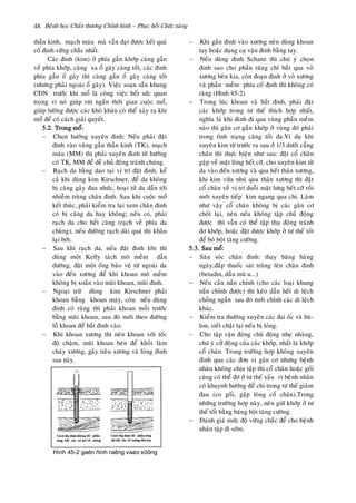 Beänh hoïc Chaán thöông Chænh hình – Phuïc hoài Chöùc naêng48
thaàn kinh, maïch maùu maø vaãn ñaït ñöôïc keát quaû
coá ñònh vöõng chaéc nhaát.
Caùc ñinh (kim) ôû phía gaàn khôùp caøng gaàn
veà phía khôùp, caøng xa oå gaõy caøng toát, caùc ñinh
phía gaàn oå gaõy thì caøng gaàn oå gaõy caøng toát
(nhöng phaûi ngoaøi oå gaõy). Vieäc soaïn saün khung
CÑN tröôùc khi moå laø coâng vieäc heát söùc quan
troïng vì noù giuùp ruùt ngaén thôøi gian cuoäc moå,
giuùp löôøng ñöôïc caùc khoù khaên coù theå xaûy ra khi
moå ñeå coù caùch giaûi quyeát.
5.2. Trong moå:
 Choïn höôùng xuyeân ñinh: Neáu phaûi ñaët
ñinh vaøo vuøng gaàn thaàn kinh (TK), maïch
maùu (MM) thì phaûi xuyeân ñinh töø höôùng
coù TK, MM ñeå deã chuû ñoäng traùnh chuùng.
 Raïch da baèng dao taïi vò trí ñaët ñinh, keå
caû khi duøng kim Kirschner, ñeå da khoâng
bò caêng gaây ñau nhöùc, hoaïi töû da daãn tôùi
nhieãm truøng chaân ñinh. Sau khi cuoäc moå
keát thuùc, phaûi kieåm tra laïi xem chaân ñinh
coù bò caêng da hay khoâng; neáu coù, phaûi
raïch da cho heát caêng (raïch veà phía da
chuøng), neáu ñöôøng raïch daøi quaù thì khaâu
laïi bôùt.
 Sau khi raïch da, neáu ñaët ñinh lôùn thì
duøng moät Kelly taùch moâ meàm daãn
ñöôøng, ñaët moät oáng baûo veä töø ngoaøi da
vaøo ñeán xöông ñeå khi khoan moâ meàm
khoâng bò xoaén vaøo muõi khoan, muõi ñinh.
 Ngoaïi tröø duøng kim Kirschner phaûi
khoan baèng khoan maùy, coøn neáu duøng
ñinh coù raêng thì phaûi khoan moài tröôùc
baèng muõi khoan, sau ñoù môùi theo ñöôøng
loã khoan ñeå baét ñinh vaøo.
 Khi khoan xöông thì neân khoan vôùi toác
ñoä chaäm, muõi khoan beùn ñeå khoûi laøm
chaùy xöông, gaây tieâu xöông vaø loûng ñinh
sau naøy.
 Khi gaén ñinh vaøo xöông neân duøng khoan
tay hoaëc duïng cuï vaën ñinh baèng tay.
 Neáu duøng ñinh Schanz thì chuù yù choïn
ñinh sao cho phaàn raêng chæ baét qua voû
xöông beân kia, coøn ñoaïn ñinh ôû voû xöông
vaø phaàn meàm phía coá ñònh thì khoâng coù
raêng (Hình 45-2)
 Trong luùc khoan vaø baét ñinh, phaûi ñaët
caùc khôùp trong tö theá thích hôïp nhaát,
nghóa laø khi ñinh ñi qua vuøng phaàn meàm
naøo thì gaân cô gaàn khôùp ôû vuøng ñoù phaûi
trong tình traïng caêng toái ña.Ví duï khi
xuyeân kim töø tröôùc ra sau ôû 1/3 döôùi caúng
chaân thì thöïc hieän nhö sau: ñaët coå chaân
gaäp veà maët loøng heát côõ, cho xuyeân kim töø
da vaøo ñeán xöông vaø qua heát thaân xöông,
khi kim vöøa nhuù qua thaân xöông thì ñaët
coå chaân veà vò trí duoãi maët löng heát côõ roài
môùi xuyeân tieáp kim ngang qua chi. Laøm
nhö vaäy coå chaân khoâng bò caùc gaân cô
choát laïi, neân neáu khoâng taäp chuû ñoäng
ñöôïc thì vaãn coù theå taäp thuï ñoäng traùnh
ñô khôùp, hoaëc ñaët ñöôïc khôùp ôû tö theá toát
ñeå boù boät taêng cöôøng.
5.3. Sau moå:
 Saên soùc chaân ñinh: thay baêng haøng
ngaøy,ñaép thuoác saùt truøng leân chaân ñinh
(betadin, daàu muø u...)
 Neáu caàn naén chænh (cho caùc loaïi khung
naén chænh ñöôïc) thì keùo daàn heát di leäch
choàng ngaén sau ñoù môùi chænh caùc di leäch
khaùc.
 Kieåm tra thöôøng xuyeân caùc ñai oác vaø buø-
lon, sieát chaët laïi neáu bò loûng.
 Cho taäp vaän ñoäng chuû ñoäng nheï nhaøng,
chuù yù cöû ñoäng cuûa caùc khôùp, nhaát laø khôùp
coå chaân. Trong tröôøng hôïp khoâng xuyeân
ñinh qua caùc ñôn vò gaân cô nhöng beänh
nhaân khoâng chòu taäp thì coå chaân hoaëc goái
cuõng coù theå ñô ôû tö theá xaáu vì beänh nhaân
coù khuynh höôùng ñeå chi trong tö theá giaûm
ñau (co goái, gaäp loøng coå chaân).Trong
nhöõng tröôøng hôïp naøy, neân giöõ khôùp ôû tö
theá toát baèng baêng boät taêng cöôøng.
 Ñaùnh giaù möùc ñoä vöõng chaéc ñeå cho beänh
nhaân taäp ñi sôùm.
Hình 45-2 gaén ñinh raêng vaøo xöông
 