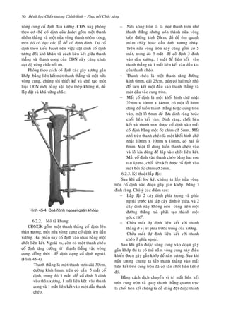 Beänh hoïc Chaán thöông Chænh hình – Phuïc hoài Chöùc naêng50
voøng cung coá ñònh ñaàu xöông. CÑN naøy phoûng
theo cô cheá coá ñònh cuûa Judet goàm moät thanh
nhoâm thaúng vaø moät nöûa voøng thanh nhoâm cong,
treân ñoù coù ñuïc caùc loã ñeå coá ñònh ñinh. Do coá
ñònh theo kieåu Judet neân vieäc ñaët ñinh coá ñònh
töông ñoái khoù khaên vaø caùch lieân keát giöõa thanh
thaúng vaø thanh cong cuûa CÑN naøy cuõng chöa
ñaït ñoä vöõng chaéc toái öu.
Phoûng theo caùch coá ñònh caùc gaõy xöông gaàn
khôùp baèng lieân keát moät thanh thaúng vaø moät nöûa
voøng cung, chuùng toâi thieát keá vaø cheá taïo moät
loaïi CÑN môùi baèng vaät lieäu theùp khoâng ræ, deã
laép ñaët vaø khaù vöõng chaéc.
6.2.2. Moâ taû khung:
CÑNGK goàm moät thanh thaúng coá ñònh leân
thaân xöông, moät nöûa voøng cung coá ñònh leân ñaàu
xöông. Hai phaàn naøy coá ñònh vaøo nhau baèng moät
choát lieân keát. Ngoaøi ra, coøn coù moät thanh cheùo
coá ñònh taêng cöôøng töø thanh thaúng vaøo voøng
cung, ñoàng thôøi ñeå ñònh daïng coá ñònh ngoaøi.
(Hình 45-4)
 Thanh thaúng laø moät thanh trôn daøi 30cm,
ñöôøng kính 8mm, treân coù gaén 5 maét coá
ñònh, trong ñoù 3 maét ñeå coá ñònh 3 ñinh
vaøo thaân xöông, 1 maét lieân keát vaøo thanh
cong vaø 1 maét lieân keát vaøo moät ñaàu thanh
cheùo.
 Nöûa voøng troøn laø laø moät thanh trôn nhö
thanh thaúng nhöng uoán thaønh nöûa voøng
troøn ñöôøng kính 20cm, ñuû ñeå oâm quanh
maâm chaøy hoaëc ñaàu döôùi xöông chaøy.
Treân nöûa voøng troøn naøy cuõng goàm coù 5
maét, trong ñoù 3 maét ñeå coá ñònh 3 ñinh
vaøo ñaàu xöông, 1 maét ñeå lieân keát vaøo
thanh thaúng vaø 1 maét lieân keát vaøo ñaàu kia
cuûa thanh cheùo.
 Thanh cheùo laø moät thanh raêng ñöôøng
kính 6mm, daøi 25cm, treân coù hai maét nhoû
ñeå lieân keát moät ñaàu vaøo thanh thaúng vaø
moät ñaàu vaøo cung troøn.
 Maét coá ñònh laø moät khoái hình chöõ nhaät
22mm x 10mm x 14mm, coù moät loã 8mm
duøng ñeå luoàn thanh thaúng hoaëc cung troøn
vaøo, moät loã 6mm ñeå ñöa ñinh raêng hoaëc
choát lieân keát vaøo. Ñinh raêng, choát lieân
keát vaø thanh trôn ñöôïc coá ñònh vaøo maét
coá ñònh baèng moät oác chìm côõ 5mm. Maét
nhoû treân thanh cheùo laø moät khoái hình chöõ
nhaät 10mm x 10mm x 18mm, coù hai loã
6mm. Moät loã duøng luoàn thanh cheùo vaøo
vaø loã kia duøng ñeå laép vaøo choát lieân keát.
Maét coá ñònh vaøo thanh cheùo baèng hai con
taùn aùp maù, choát lieân keát ñöôïc coá ñònh vaøo
maét bôûi oác chìm côõ 5mm.
6.2.3. Kyõ thuaät laép ñaët:
Sau khi caét loïc kyõ, chuùng ta laép nöûa voøng
troøn coá ñònh vaøo ñoaïn gaõy gaàn khôùp baèng 3
ñinh raêng. Chuù yù caùc ñieåm sau:
 Laép ñaët 2 caây ñinh phía trong vaø phía
ngoaøi tröôùc khi laép caây ñinh ôû giöõa, vaø 2
caây ñinh naøy khoâng neân cuøng treân moät
ñöôøng thaúng maø phaûi taïo thaønh moät
goùc<1800
.
 Chöøa maét döï ñònh lieân keát vôùi thanh
thaúng ôû vò trí phía tröôùc trong cuûa xöông.
 Chöøa maét döï ñònh lieân keát vôùi thanh
cheùo ôû phía ngoaøi.
Sau khi gaén ñöôïc voøng cung vaøo ñoaïn gaõy
gaàn khôùp thì ta coù theå naém voøng cung naøy ñieàu
khieån ñoaïn gaõy gaàn khôùp ñeå naén xöông. Sau khi
naén xöông chuùng ta laép thanh thaúng vaøo maét
lieân keát treân cung troøn ñaõ coù saün choát lieân keát ôû
ñoù.
Baèng caùch dòch chuyeån vò trí maét lieân keát
treân cung troøn vaø quay thanh thaúng quanh truïc
laø choát lieân keát chuùng ta deã daøng ñaët ñöôïc thanh
Hình 45-4 Coá ñònh ngoaøi gaàn khôùp
 