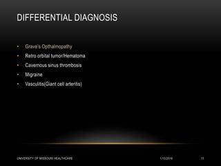 DIFFERENTIAL DIAGNOSIS
• Grave’s Opthalmopathy
• Retro orbital tumor/Hematoma
• Cavernous sinus thrombosis
• Migraine
• Vasculitis(Giant cell arteritis)
1/10/2016UNIVERSITY OF MISSOURI HEALTHCARE 11
 