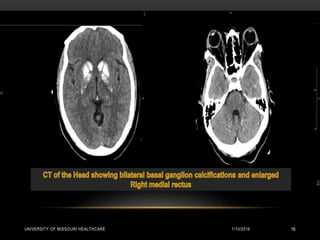 1/10/2016UNIVERSITY OF MISSOURI HEALTHCARE 16
 