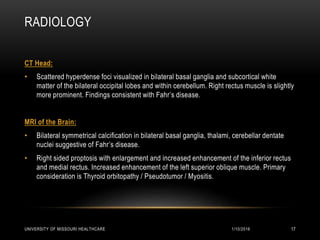 RADIOLOGY
CT Head:
• Scattered hyperdense foci visualized in bilateral basal ganglia and subcortical white
matter of the bilateral occipital lobes and within cerebellum. Right rectus muscle is slightly
more prominent. Findings consistent with Fahr’s disease.
MRI of the Brain:
• Bilateral symmetrical calcification in bilateral basal ganglia, thalami, cerebellar dentate
nuclei suggestive of Fahr’s disease.
• Right sided proptosis with enlargement and increased enhancement of the inferior rectus
and medial rectus. Increased enhancement of the left superior oblique muscle. Primary
consideration is Thyroid orbitopathy / Pseudotumor / Myositis.
1/10/2016UNIVERSITY OF MISSOURI HEALTHCARE 17
 