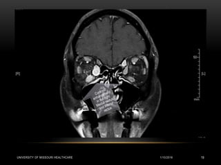 1/10/2016UNIVERSITY OF MISSOURI HEALTHCARE 19
 