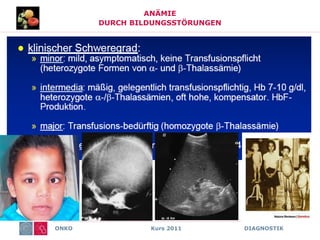 ONKO Kurs 2011 DIAGNOSTIK
ANÄMIE
DURCH BILDUNGSSTÖRUNGEN
 