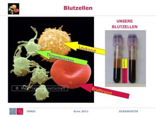 ONKO Kurs 2011 DIAGNOSTIK
Blutzellen
UNSERE
BLUTZELLEN
PLASMA
BLUTZELLEN
 