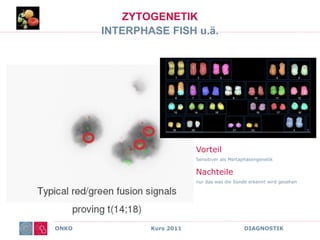 ONKO Kurs 2011 DIAGNOSTIK
ZYTOGENETIK
INTERPHASE FISH u.ä.
Vorteil
Sensitiver als Mertaphasengenetik
Nachteile
nur das was die Sonde erkennt wird gesehen
 