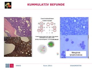 ONKO Kurs 2011 DIAGNOSTIK
KUMMULATIV BEFUNDE
 