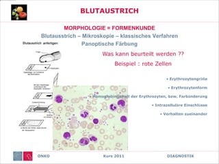 ONKO Kurs 2011 DIAGNOSTIK
BLUTAUSTRICH
MORPHOLOGIE = FORMENKUNDE
Blutausstrich – Mikroskopie – klassisches Verfahren
Panoptische Färbung
Was kann beurteilt werden ??
Beispiel : rote Zellen
• Erythrozytengröße
• Erythrozytenform
• Hämoglobingehalt der Erythrozyten, bzw. Farbänderung
• Intrazelluläre Einschlüsse
• Verhalten zueinander
 