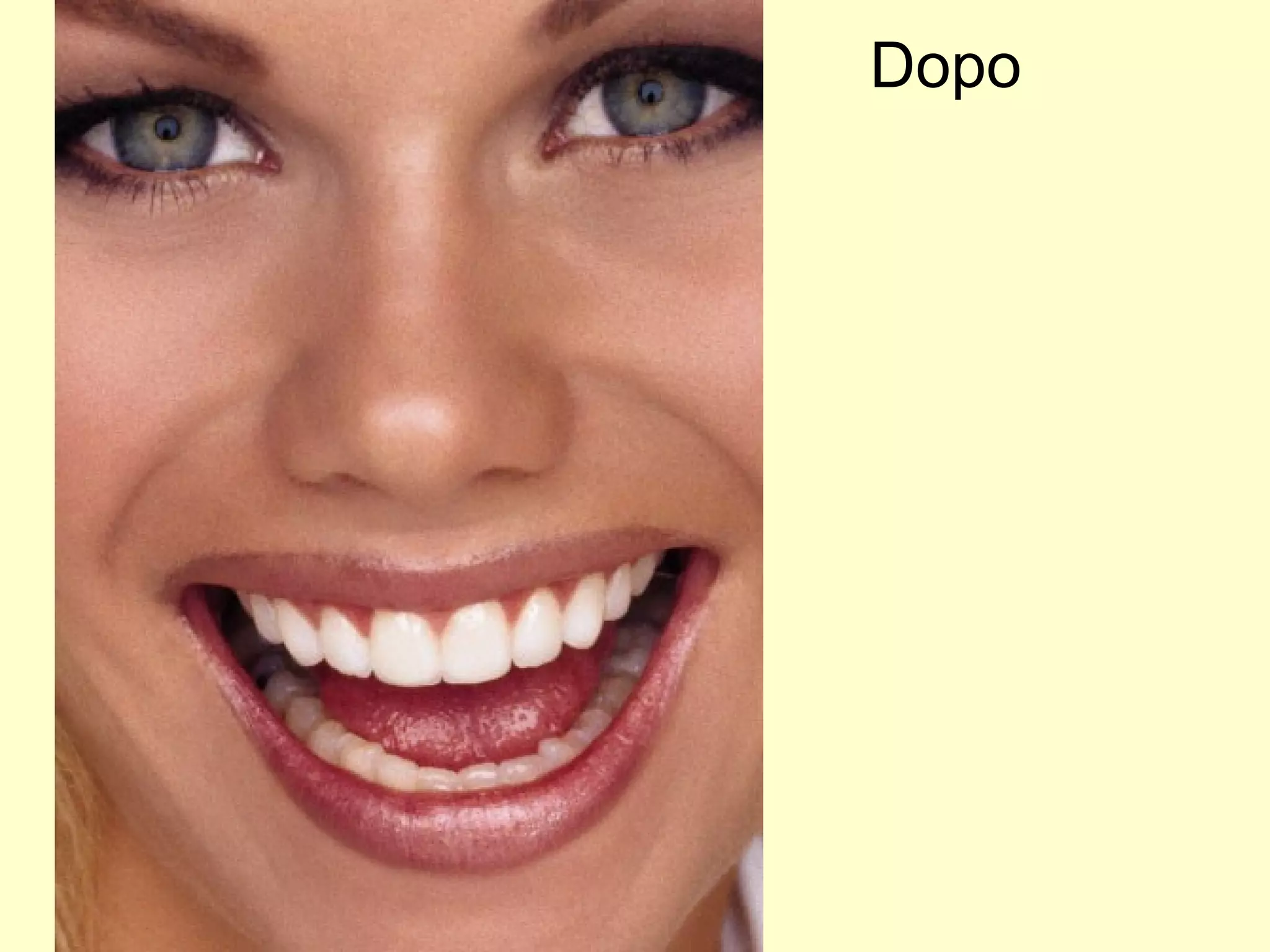 Dopo