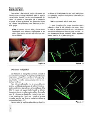 Manual de prácticas
Endodoncia clínica
14
La prueba al calor se puede realizar calentando una
barrita de gutapercha y colocándola sobre la superfi-
cie del diente, untando vaselina entre la superficie del
diente y la gutapercha para evitar que la gutapercha
se pegue al diente y producir una quemadura (figura
9). También esta prueba nos sirve para detectar vita-
lidad pulpar.
NOTA: Si aplicamos la prueba al frío y con esta prueba
consideramos haber obtenido el dato buscado de una
manera clara, ya no es necesario aplicar las otras prue-
bas de vitalidad.
c) Examen radiográfico
La obtención de radiografías de buena calidad es
de suma importancia para el diagnóstico y tratamiento
endodóntico, por lo que deberán ser reveladas, fija-
das, lavadas y secadas adecuadamente antes de mos-
trarla al profesor.
Para obtener radiografías con la menor distorsión
posible, se utilizarán las técnicas de la bisectriz o técni-
ca del paralelismo dependiendo del caso (figuras 10 y
11). En cuanto a la angulación horizontal, se deberán
tomar en sentido ortorradial, mesiorradial o distorradial
para de esta manera disociar los conductos que apa-
recen superpuestos como por ejemplo el primer
premolar superior que tiene un conducto vestibular y
otro palatino (figura 12).
La colocación de la placa radiográfica en el pacien-
te siempre se deberá hacer con una pinza portaagujas
o de mosquito o algún otro dispositivo para radiogra-
fías (figura 13).
NOTA: no detener la película con el dedo.
La toma de radiografías en pacientes que tienen
colocado el dique de hule, dificulta en ocasiones la co-
locación de manera correcta de la placa, en estos ca-
sos deberá desalojarse el arco de young del hule y de
esta manera tener mayor visibilidad para el posiciona-
miento correcto de la placa radiográfica.
Figura 11
Figura 9 Figura 10
 