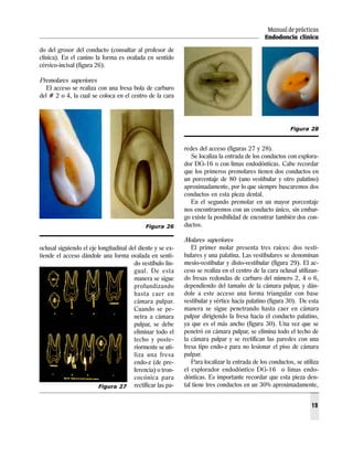Manual de prácticas
Endodoncia clínica
19
do del grosor del conducto (consultar al profesor de
clínica). En el canino la forma es ovalada en sentido
cérvico-incisal (figura 26).
Premolares superiores
El acceso se realiza con una fresa bola de carburo
del # 2 o 4, la cual se coloca en el centro de la cara
oclusal siguiendo el eje longitudinal del diente y se ex-
tiende el acceso dándole una forma ovalada en senti-
do vestíbulo lin-
gual. De esta
manera se sigue
profundizando
hasta caer en
cámara pulpar.
Cuando se pe-
netra a cámara
pulpar, se debe
eliminar todo el
techo y poste-
riormente se uti-
liza una fresa
endo-z (de pre-
ferencia) o tron-
cocónica para
rectificar las pa-
redes del acceso (figuras 27 y 28).
Se localiza la entrada de los conductos con explora-
dor DG-16 o con limas endodónticas. Cabe recordar
que los primeros premolares tienen dos conductos en
un porcentaje de 80 (uno vestibular y otro palatino)
aproximadamente, por lo que siempre buscaremos dos
conductos en esta pieza dental.
En el segundo premolar en un mayor porcentaje
nos encontraremos con un conducto único, sin embar-
go existe la posibilidad de encontrar también dos con-
ductos.
Molares superiores
El primer molar presenta tres raíces: dos vesti-
bulares y una palatina. Las vestibulares se denominan
mesio-vestibular y disto-vestibular (figura 29). El ac-
ceso se realiza en el centro de la cara oclusal utilizan-
do fresas redondas de carburo del número 2, 4 o 6,
dependiendo del tamaño de la cámara pulpar, y dán-
dole a este acceso una forma triangular con base
vestibular y vértice hacia palatino (figura 30). De esta
manera se sigue penetrando hasta caer en cámara
pulpar dirigiendo la fresa hacia el conducto palatino,
ya que es el más ancho (figura 30). Una vez que se
penetró en cámara pulpar, se elimina todo el techo de
la cámara pulpar y se rectifican las paredes con una
fresa tipo endo-z para no lesionar el piso de cámara
pulpar.
Para localizar la entrada de los conductos, se utiliza
el explorador endodóntico DG-16 o limas endo-
dónticas. Es importante recordar que esta pieza den-
tal tiene tres conductos en un 30% aproximadamente,Figura 27
Figura 28
Figura 26
 
