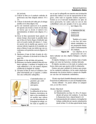 Manual de prácticas
Endodoncia clínica
27
del paciente.
e) Colocar la lima en el conducto radicular de
preferencia una lima delgada número 10 o
15.
f) Colocar el electrodo del cable gris al vástago
metálico de la lima (figura 53).
g) En este momento aparecerá en la pantalla
del aparato una lectura a través de una línea
de barras que va desde el número tres
aproximándose al número uno (figuras 51 y
53).
h) Llevar la lima suavemente hacia apical y al
mismo tiempo observando la pantalla hasta
que la línea de barras llegue al indicador que
está en la parte media del número 1. Cuan-
do sucede esto la muelita que aparece en el
extremo inferior izquierdo de la pantalla em-
pieza a falsear, lo que nos indica que nos en-
contramos en la posición correcta (figuras 51
y 53).
i) Ajustamos el tope de hule al punto de refe-
rencia y retiramos el electrodo de la lima (fi-
gura 53).
j) Quitamos el clip del labio del paciente.
k) Retiramos con mucho cuidado la lima del con-
ducto radicular y medimos la longitud en la
regla milimétrica y de esta manera dejamos
establecida la longitud de trabajo.
l) Llevamos la lima de nuevo al conducto a lon-
gitud determinada por el aparato y realiza-
mos una verificación radiográfica.
Contraindicaciones en
pacientes que estén
utilizando un
marcapaso.
Comentarios
La utilización de los loca-
lizadores electrónicos de
ápice se ha constituido en
un auxiliar muy valioso
para la determinación de
la longitud de trabajo, so-
bre todo en aquellos ca-
sos en que la radiografía nos muestra una terminación
apical muy confusa o en caso de superposición de imá-
genes, sobre todo en segundos molares superiores.
Existen ya en el mercado localizadores de ápice de
nueva generación, los cuales cada vez son de más
confiabilidad como por ejemplo el de la casa sybron
kerr (figura 54).
6. PREPARACIÓN DEL
CONDUCTO
RADICULAR
También se le conoce
a esta fase del trata-
miento endodóntico co-
mo preparación biome-
cánica o instrumentación
del conducto.
Los objetivos de la
preparación del con-
ducto radicular son dos: objetivo biológico y objetivo
mecánico.
El objetivo biológico es el de eliminar todo el tejido
pulpar, así como las bacterias y dentina infectada.
El objetivo mecánico es el de darle al conducto una
forma cónica para que pueda recibir la obturación.
Existen una gran cantidad de técnicas para prepa-
rar los conductos radiculares, de las cuales elegiremos
únicamente dos técnicas básicas a manera de simplifi-
car esta fase del tratamiento endodóntico.
Técnica step-back (también llamada telescópica).—
Esta técnica la utilizaremos en casos de biopulpectomía.
Técnica híbrida— Se puede utilizar en cualquier
caso, ya sea bio o necro.
Tecnica Step-back:
a) Apertura coronaria.
b) Odontometría con lima 15, 20 o 25 depen-
diendo del grosor del conducto. A esta lima
le llamaremos Lim a Apical Inicial L.A.I.
c) Instrumentación del conducto a la longitud de
trabajo establecida por nuestra odontometría
desde la lima 15 o la lima apical inicial, hasta
Figura 53
Figura 54
 