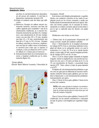 Manual de prácticas
Endodoncia clínica
28
una lima, la cual determinaremos dependien-
do del grosor del conducto. A esta lima le
llamaremos instrumento memoria I.M.
d) Irrigar el conducto cada dos limas que utili-
cemos.
e) Retroceso: Después de utilizar nuestro ins-
trumento memoria, usaremos una lima del
calibre siguiente pero restándole 1 mm de la
odontometría establecida, ej: si nuestro ins-
trumento memoria fue una lima 45 y trabaja-
mos a una odontometría de 20 mm, trabaja-
remos con una lima 50 a 19 mm, después
una lima 55 a 18 mm, posteriormente una
lima 60 a 17 mm, la 70 a 16 mm. Después
de utilizar cada lima en retroceso, empleare-
mos una lima de calibre menor al instrumen-
to memoria para evitar que se taponee el
conducto, a esto se le llama RECAPITULACIÓN.
Se utilizan 4 o 5 limas para el retroceso.
f) Instrumentación final con el instrumento me-
moria a longitud establecida por la odon-
tometría (figura 55).
Técnica híbrida
(Doctor Mario Roberto Leonardo, Universidad de
Araraquara, Brasil)
Esta técnica está dirigida principalmente a aquellos
dientes con conductos estrechos en los cuales la am-
pliación previa de los tercios coronario y medio nos
facilita mucho la instrumentación del tercio apical. Ade-
más esta técnica cumple con el concepto de instru-
mentación en sentido coronario apical (crown-down )
por lo que es aplicable para los dientes con pulpa
necrótica.
Dividiremos esta técnica en dos fases:
— Primera fase de la preparación: Preparación del
tercio cervical y medio del conducto radicular.
Paso 1. Determinación de la longitud provisional
de trabajo (LPT): Esta se determina midiendo la lon-
gitud del diente en la radiografía inicial a la cual le
restaremos 4 o 5 mm. Ej. Si en la rx. inicial nuestro
diente a tratar mide 20 mm, nuestra longitud provisio-
nal de trabajo (LPT) será de 16 mm.
Paso 2. Con la cámara pulpar inundada de líquido
irrigante, iniciar la ampliación de esta porción del con-
ducto (en este caso a 16 mm) con limas de la 15 a la
35 con movimientos de limado y ensanchado hasta
nuestra LPT. Nota: colocar el tope de goma ajustado
a la LPT.
El objetivo de esta instrumentación preliminar es que
nos sirva de guía para la utilización de nuestros instru-
mentos rotatorios (fresas gates glidden), por eso tam-
bién le llamaremos a esta instrumentación preliminar:
instrumentación pre-gates.
Paso 3. Llevar la fresa gates-glidden 3 hasta tercio
cervical del conducto.
NOTA: debe entrar girando al conducto con movimien-
tos de entrada y salida únicamente dos o tres veces y
dejar de accionar nuestra pieza de mano hasta que esté
fuera del conducto. Irrigación.
Paso 4. Llevar la fresa gates-glidden 2 hasta la LPT
establecida con los mismos movimientos y colocando
un tope de goma a esta longitud por seguridad. Irriga-
ción.
Figura 55
 