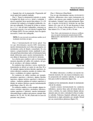 Manual de prácticas
Endodoncia clínica
29
— Segunda fase de la preparación: Preparación del
tercio apical del conducto radicular.
Paso 1. Tomar la odontometría teniendo en cuenta
la longitud del diente en la rx. inicial y restándole 1
mm de seguridad, llevar nuestra lima número 15 o 20
al interior del conducto a la longitud establecida y to-
mar una radiografía. Si la punta de la lima se encuen-
tra a .5 o 1 mm del ápice radiográfico, estaremos en
la posición correcta y esa será nuestra Longitud Real
de Trabajo (LRT). En caso contrario, hacer los ajustes
necesarios y tomar otra radiografía.
NOTA: En caso necesario nos podremos auxiliar con el
localizador electrónico de ápice.
Paso 2. Instrumentación del tercio apical. Una
vez que determinamos nuestra LRT, iniciaremos
nuestra instrumentación con la lima más pequeña con
movimientos cortos de limado y ensanchado. De esta
manera y progresivamente iremos ampliando la por-
ción apical hasta determinar cuál es el instrumento hasta
donde deberemos parar nuestra instrumentación. A
este último le llamaremos INSTRUMENTO MEMORIA.
Los criterios para establecer cuál es el instrumento
memoria dependen del calibre del conducto, del gra-
do de curvatura y del volumen radicular.
En conductos muy estrechos y curvos, nuestra ins-
trumentación no deberá ser mayor de una lima 30 o
35, ejemplo: algunos incisivos laterales superiores, in-
cisivos inferiores conductos mesiales de molares infe-
riores y vestibulares de molares superiores.
En conductos de calibre mediano por ejemplo:
premolares superiores e inferiores, algunos laterales
superiores, algunos incisivos superiores e inferiores y
caninos, conductos palatinos de molares superiores y
distales de molares inferiores nuestra instrumentación
podrá llegar a lima 35, 40 o 45.
En conductos amplios y rectos ejemplo: algunos in-
cisivos centrales superiores, premolares inferiores,
caninos superiores e inferiores, nuestra instrumenta-
ción podría llegar a calibres más gruesos, ejemplo: lima
números 50, 55, 60, 70, 80 y hasta más en casos de
pacientes muy jóvenes.
Paso 3. Retroceso (Step-Back)
Una vez que determinamos nuestro INSTRUMENTO
MEMORIA, utilizaremos otros cuatro instrumentos de
calibres más gruesos para ampliar la porción apical
del conducto, restando 1 mm a cada instrumento. Ejem-
plo: si nuestro INSTRUMENTO MEMORIA fue una lima
número 40 a una LRT de 20 mm llevaremos la lima
número 45 a 19 mm, la lima número 50 a 18 mm, la
lima número 55 a 17 mm y la 60 a 16 mm.
Nota: Entre cada instrumento de retroceso rectificare-
mos con nuestro instrumento memoria hasta la LRT.
IRRIGACIÓN ABUNDANTE CADA DOS INSTRU-
MENTOS.
Por último volveremos a rectificar con nuestro ins-
trumento memoria. De esta manera terminamos nues-
tra preparación del conducto radicular, el cual queda
listo para recibir la obturación (figura 56).
Limpieza de los instrumentos durante la instrumenta-
ción de los mismos
Cuando estamos instrumentando los conductos
radiculares, nuestras limas salen del mismo llenas de
restos y detritus, los cuales debemos limpiar adecua-
damente antes de volver a introducir la lima al conduc-
to radicular. Podremos limpiarlo utilizando una gasa
humedecida en algún antiséptico por ejemplo: Benzal
por sus características jabonosas (figura 57).
Figura 56
 
